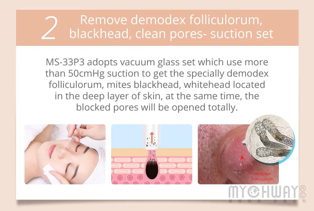 Mychway 3 In 1 Ultrasound Dermabrasion Facial Skin Care Device